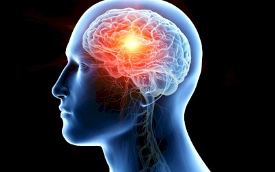 Jak uniknąć udaru mózgu?